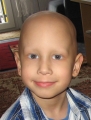 Norbika kemoterápiát és sugárkezelést is kapott, de hiába