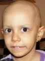 Zorka daganatos kislány története